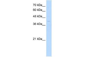 WB Suggested Anti-MKX Antibody Titration: 0. (MKX antibody  (Middle Region))