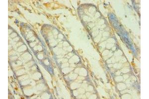 Immunohistochemistry of paraffin-embedded human colon tissue using ABIN7145745 at dilution of 1:100 (BCAT2 antibody  (AA 20-200))