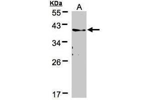 WB Image Sample(30 μg of whole cell lysate) A:A431, 12% SDS PAGE antibody diluted at 1:500