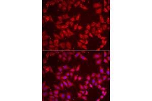 Immunofluorescence analysis of MCF7 cells using BAP1 antibody. (BAP1 antibody  (AA 460-729))