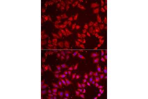 Immunofluorescence analysis of MCF7 cells using BAP1 antibody.