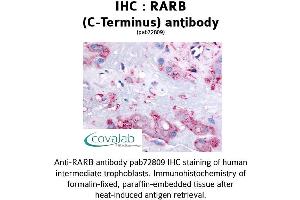 Image no. 1 for anti-Retinoic Acid Receptor, beta (RARB) (C-Term) antibody (ABIN1738735) (Retinoic Acid Receptor beta antibody  (C-Term))