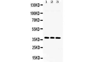 Western blot analysis of LDHB expression in rat brain extract ( Lane 1), NIH3T3 whole cell lysates ( Lane 2) and U2OS whole cell lysates ( Lane 3). (LDHB antibody  (AA 237-334))
