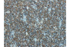 Immunohistochemistry (IHC) image for anti-Protein tyrosine Phosphatase, Receptor Type, C (PTPRC) (AA 1277-1292), (C-Term) antibody (ABIN870386)