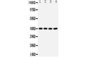 Western Blotting (WB) image for anti-Chemokine (C-X-C Motif) Receptor 1 (CXCR1) (AA 24-38), (N-Term) antibody (ABIN3042912) (CXCR1 antibody  (N-Term))