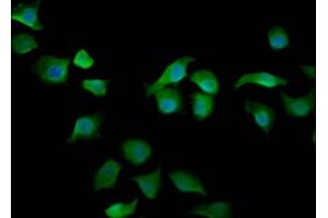 Immunofluorescence staining of A549 cells with ABIN7167931 at 1:200, counter-stained with DAPI. (ARHGAP15 antibody  (AA 1-154))