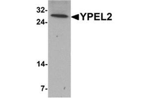 Western blot analysis of YPEL2 in HeLa cell lysate with YPEL2 antibody at 1 ug/mL.