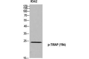 Western Blot (WB) analysis of K562 using p-TIRAP (Y86) antibody.