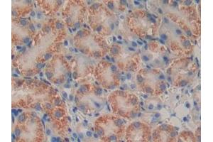 Detection of PSMB9 in Mouse Kidney Tissue using Polyclonal Antibody to Proteasome subunit beta type-9 (PSMB9) (PSMB9 antibody  (AA 22-219))