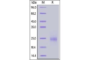 SDS-PAGE (SDS) image for Thymic Stromal Lymphopoietin (TSLP) (AA 20-140) protein (His tag) (ABIN6950973)
