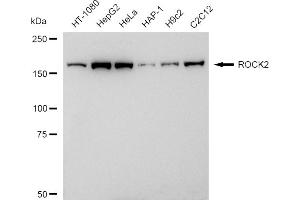 Western blotting analysis using ROCK2 antibody (ABIN7800205). (Recombinant ROCK2 antibody)