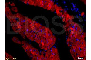 Formalin-fixed and paraffin embedded rat heart tissue labeled with Rabbit Anti-DOG-1/TMEM16A Polyclonal Antibody, Unconjugated (ABIN704216) at 1:200 followed by conjugation to the secondary antibody and DAB staining.