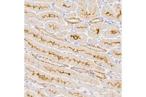 Immunohistochemistry (IHC) image for anti-Sodium Potassium ATPase, alpha1 (ATP1A1) (AA 1-100) antibody (ABIN6137299)