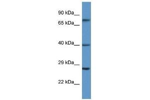 Western Blot showing AGTR2 antibody used at a concentration of 1. (Angiotensin II Type 2 Receptor antibody  (N-Term))