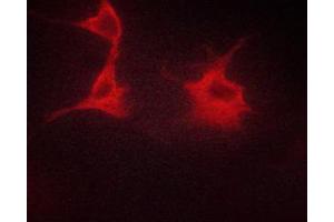 ABIN6267329 staining HeLa cells by ICC/IF. (beta 2 Adrenergic Receptor antibody  (pSer346))