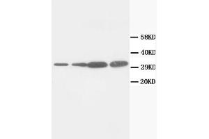 Western Blotting (WB) image for anti-Proliferating Cell Nuclear Antigen (PCNA) antibody (ABIN1108598) (PCNA antibody)