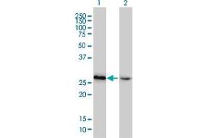 Lane 1: HMGB2 transfected lysate ( 22 KDa). (HMGB2 HEK293 Cell Transient Overexpression Lysate(Non-Denatured))