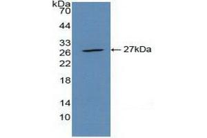 Western blot analysis of recombinant Mouse CLEC10A. (CLEC10A antibody  (AA 69-273))