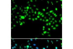 Immunofluorescence analysis of MCF-7 cells using SRSF4 Polyclonal Antibody (SRSF4 antibody)