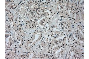 Image no. 2 for anti-Cancer/testis Antigen 1B (CTAG1B) antibody (ABIN1499899) (CTAG1B antibody)