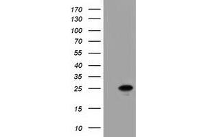 HEK293T cells were transfected with the pCMV6-ENTRY control (Left lane) or pCMV6-ENTRY AK3 (Right lane) cDNA for 48 hrs and lysed. (Adenylate Kinase 3 antibody)