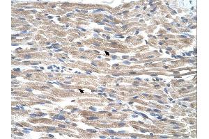 BMP2K antibody was used for immunohistochemistry at a concentration of 4-8 ug/ml. (BMP2K antibody  (C-Term))