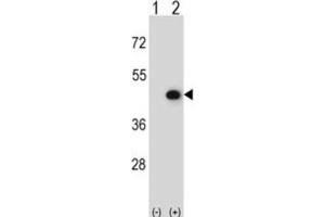Western Blotting (WB) image for anti-Creatine Kinase, Mitochondrial 2 (Sarcomeric) (CKMT2) antibody (ABIN3002972) (CKMT2 antibody)
