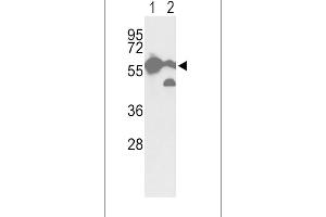 Western blot analysis of hPKM2-N491 in A2058 cell line(lane 1) and mouse brain tissue(lane 2) lysates (35ug/lane) (Pyruvate Kinase antibody  (C-Term))