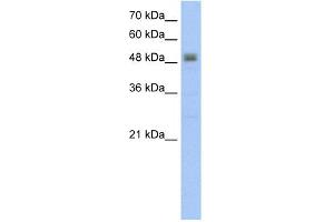 WB Suggested Anti-RSAD2 Antibody Titration:  5.