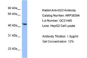 WB Suggested Anti-EED Antibody Titration: 0. (EED antibody  (N-Term))