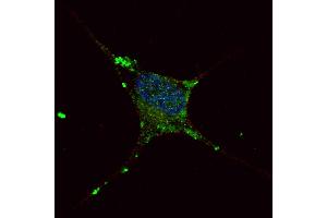Fluorescent confocal image of SY5Y cells stained with ELP2 (C-term) antibody. (ELP2 antibody  (C-Term))