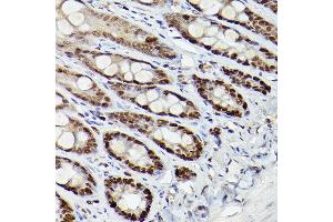 Immunohistochemistry (IHC) image for anti-Histone Deacetylase 9 (HDAC9) (AA 1-100) antibody (ABIN3022054)
