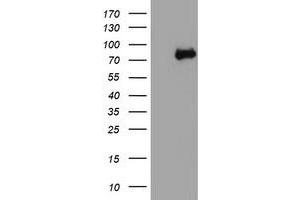 HEK293T cells were transfected with the pCMV6-ENTRY control (Left lane) or pCMV6-ENTRY NLN (Right lane) cDNA for 48 hrs and lysed. (NLN antibody)