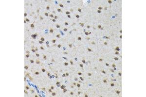 Immunohistochemistry of paraffin-embedded rat brain using SMN1 Rabbit mAb (ABIN7270651) at dilution of 1:100 (40x lens). (SMN1 antibody)
