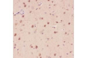 Anti-Crk p38 Picoband antibody,  IHC(P): Rat Brain Tissue (Crk antibody  (AA 2-246))