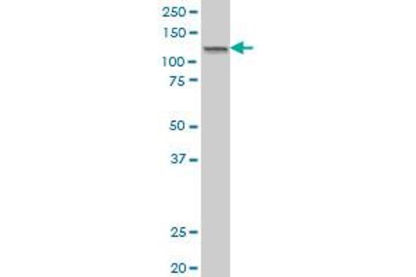 JARID2 antibody  (AA 1130-1229)