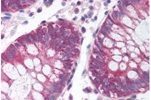 Human Colon (formalin-fixed, paraffin-embedded) stained with MKI67IP antibody ABIN214124 at 5 ug/ml followed by biotinylated goat anti-rabbit IgG secondary antibody ABIN481713, alkaline phosphatase-streptavidin and chromogen. (NIFK antibody  (AA 140-189))