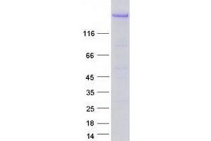 Validation with Western Blot (DICER1 Protein (Transcript Variant 1) (Myc-DYKDDDDK Tag))