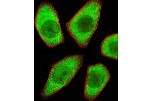 Fluorescent image of A549 cells stained with STRADA Antibody (C-term) C. (STRADA antibody  (C-Term))