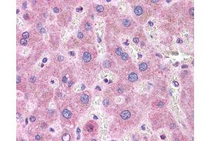 ApoB antibody was used for immunohistochemistry at a concentration of 4-8 ug/ml. (APOB antibody  (Middle Region))