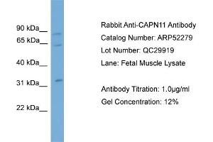 WB Suggested Anti-CAPN11  Antibody Titration: 0. (CAPN11 antibody  (N-Term))
