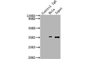 Immunoprecipitating SUMF2 in Hela whole cell lysate Lane 1: Rabbit control IgG instead of ABIN7170931 in Hela whole cell lysate. (SUMF2 antibody  (AA 26-301))