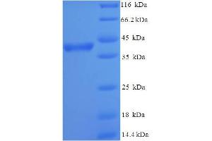 SDS-PAGE (SDS) image for Acrosomal Vesicle Protein 1 (ACRV1) (AA 22-265) protein (His-SUMO Tag) (ABIN5708993) (ACRV1 Protein (AA 22-265) (His-SUMO Tag))