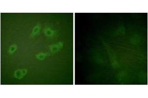 Immunofluorescence analysis of HuvEc cells, using HER3 (Phospho-Tyr1222) Antibody. (ERBB3 antibody  (pTyr1222))
