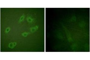 Immunofluorescence analysis of HuvEc cells, using HER3 (Phospho-Tyr1222) Antibody. (ERBB3 antibody  (pTyr1222))