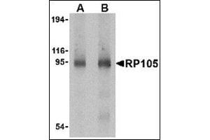 Western blot analysis of RP105 in human spleen tissue lysate with this product at (A) 0.
