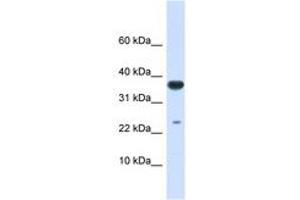 Image no. 1 for anti-Ubiquitin-Conjugating Enzyme E2D 2 (UBE2D2) (AA 36-85) antibody (ABIN6743144) (UBE2D2 antibody  (AA 36-85))