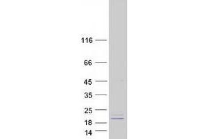 MRPS28 Protein (Myc-DYKDDDDK Tag)