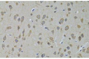 Immunohistochemistry of paraffin-embedded Rat brain using ADH5 Polyclonal Antibody at dilution of 1:100 (40x lens). (ADH5 antibody)