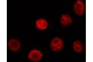 ABIN6276929 staining Hela by IF/ICC. (DKC1 antibody  (Internal Region))